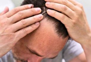 Male examining receding hairline - Understanding Male Pattern Balding